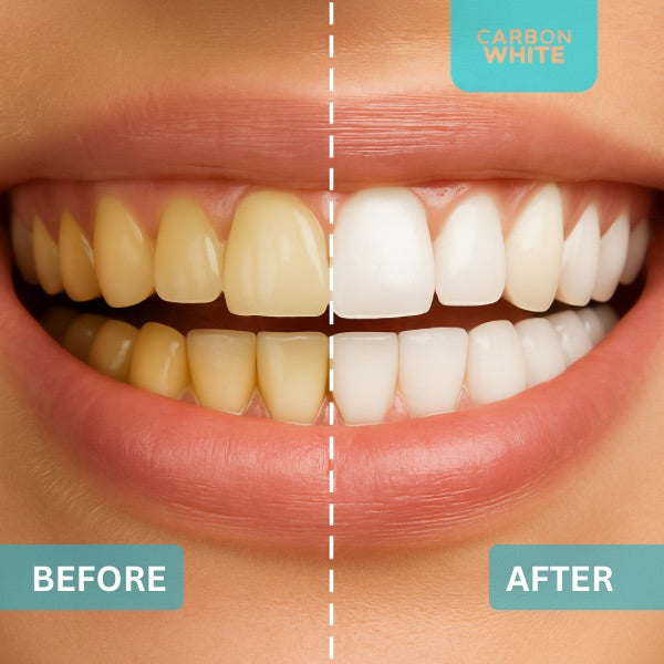 Carbon White – Charcoal Teeth Whitener Powder – Natural, Vegan, Coconut (30g)