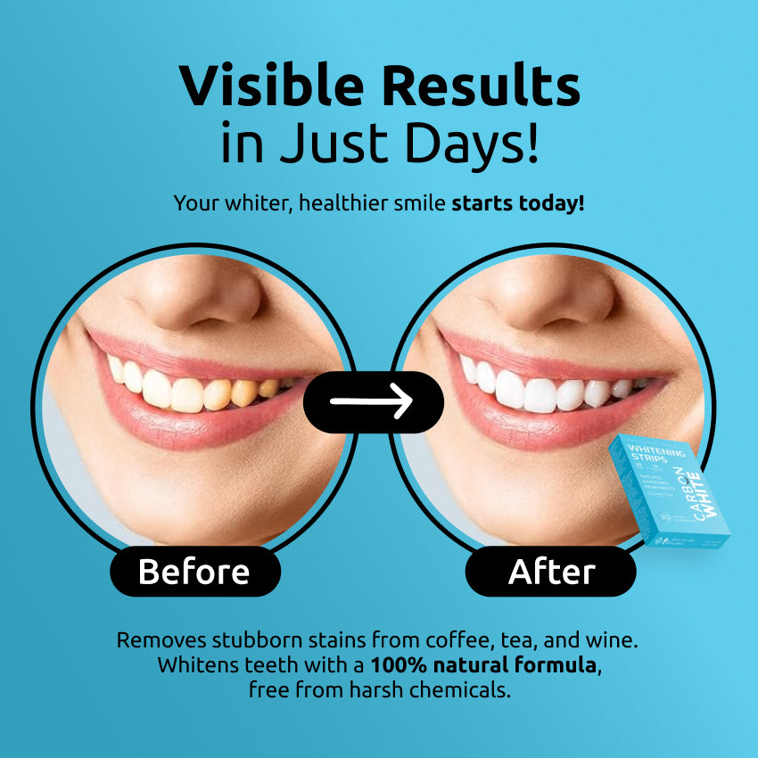 Carbon White – Teeth Whitening Strips (28) – No Peroxide, Sensitive Safe, Fast Results
