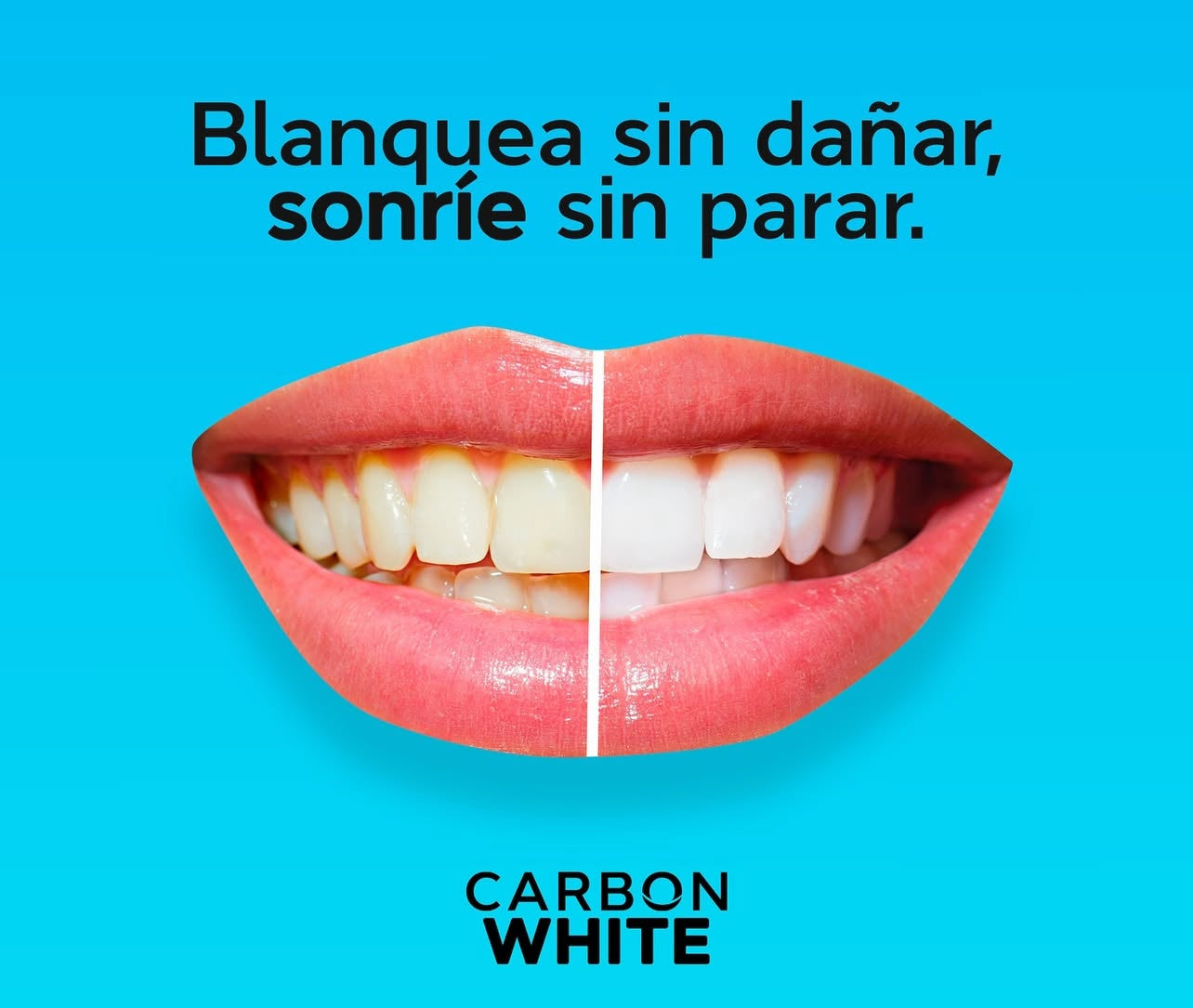 Carbon White – Teeth Whitening Strips (28) – No Peroxide, Sensitive Safe, Fast Results